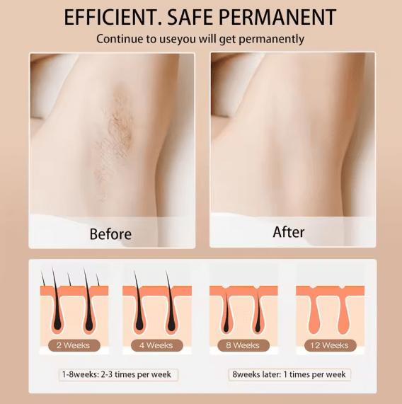 Babyverse - Digital IPL Hair Removal Device ©
