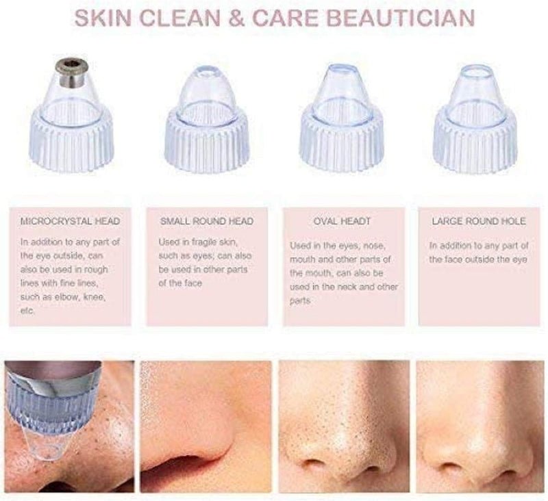 Pore Cleaning Device – Blackhead Remover & Skin Vacuum - Barakah Store