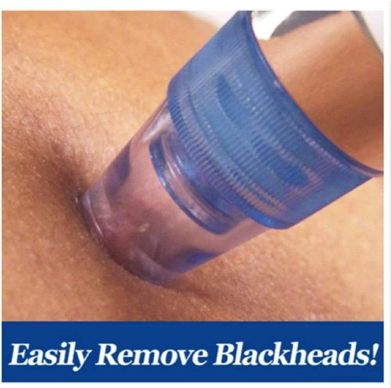 Pore Cleaning Device – Blackhead Remover & Skin Vacuum - Barakah Store